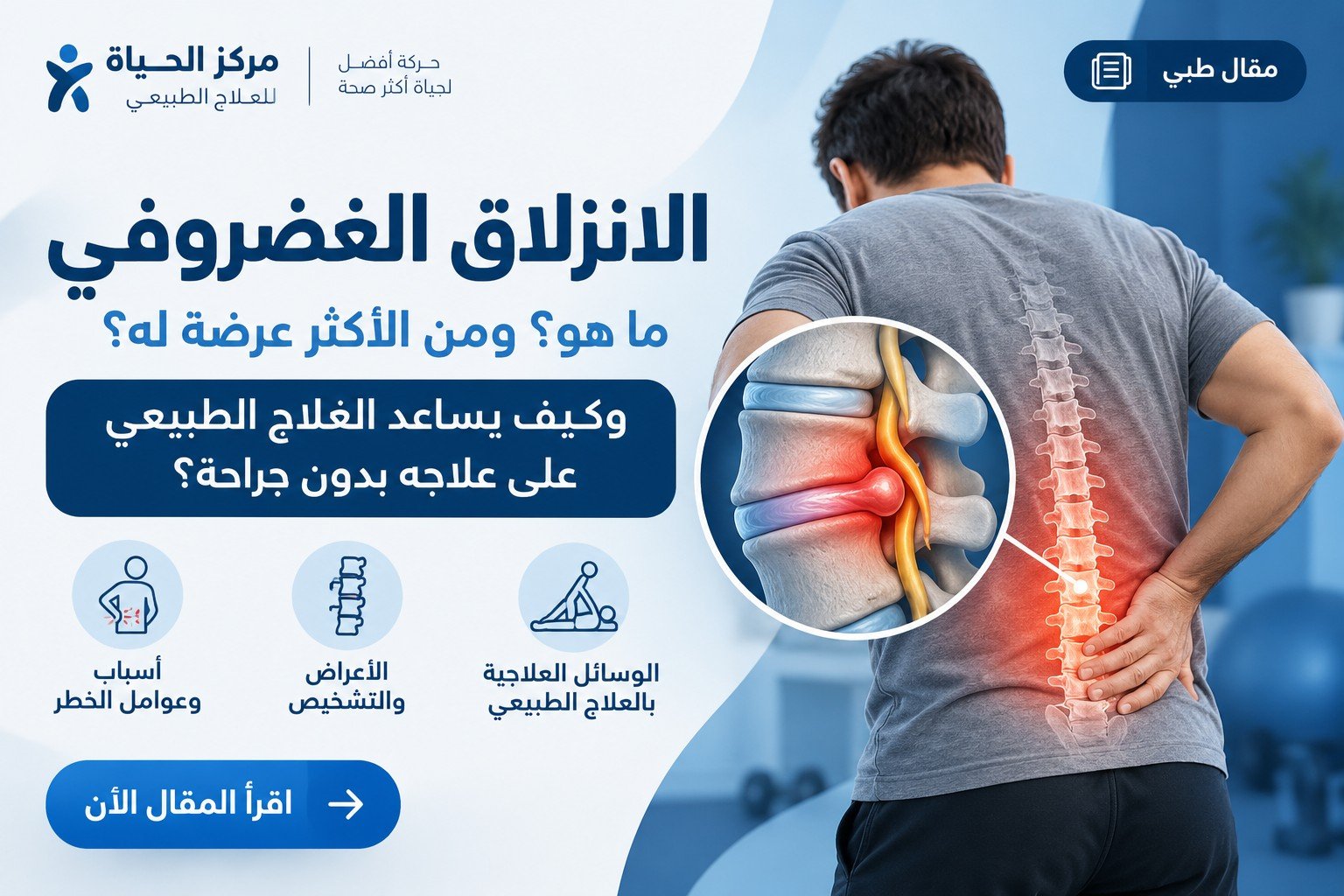 الانزلاق الغضروفي: ما هو؟ ومن الأكثر عرضة له؟ وكيف يساعد العلاج الطبيعي على علاجه بدون جراحة؟